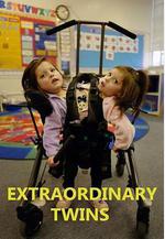 連體雙胞胎 第一季 Extraordinary Twins Season 1線上看